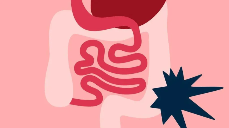 Soigner les troubles digestif naturellement - Par SevNaturo - Naturopathe à Lille