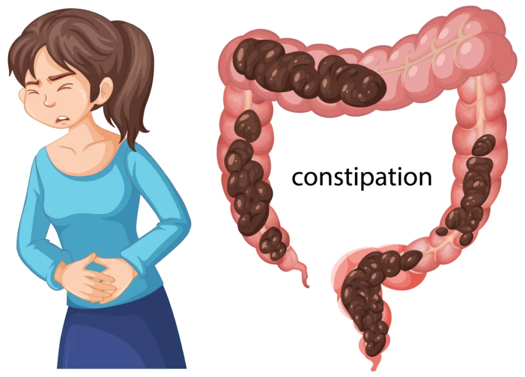 Constipation et stress