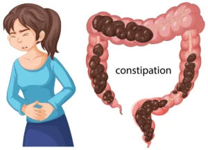 Constipation et stress