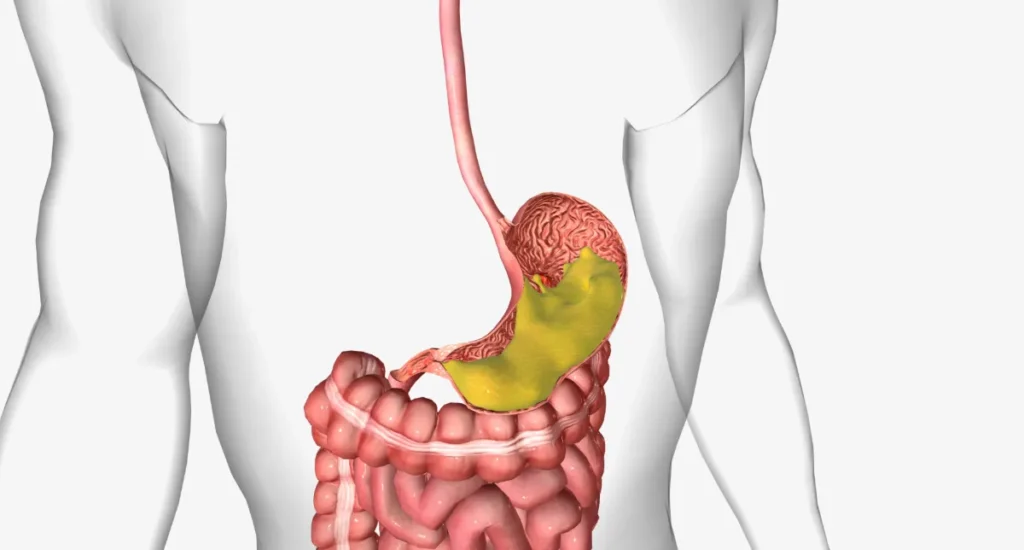remontées acides : que faire