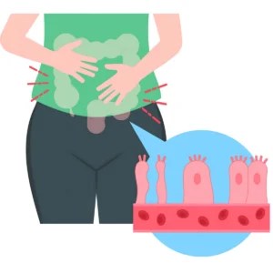 gaz coincé : que faire solutions naturelles