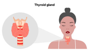 digestion lente : que faire ?